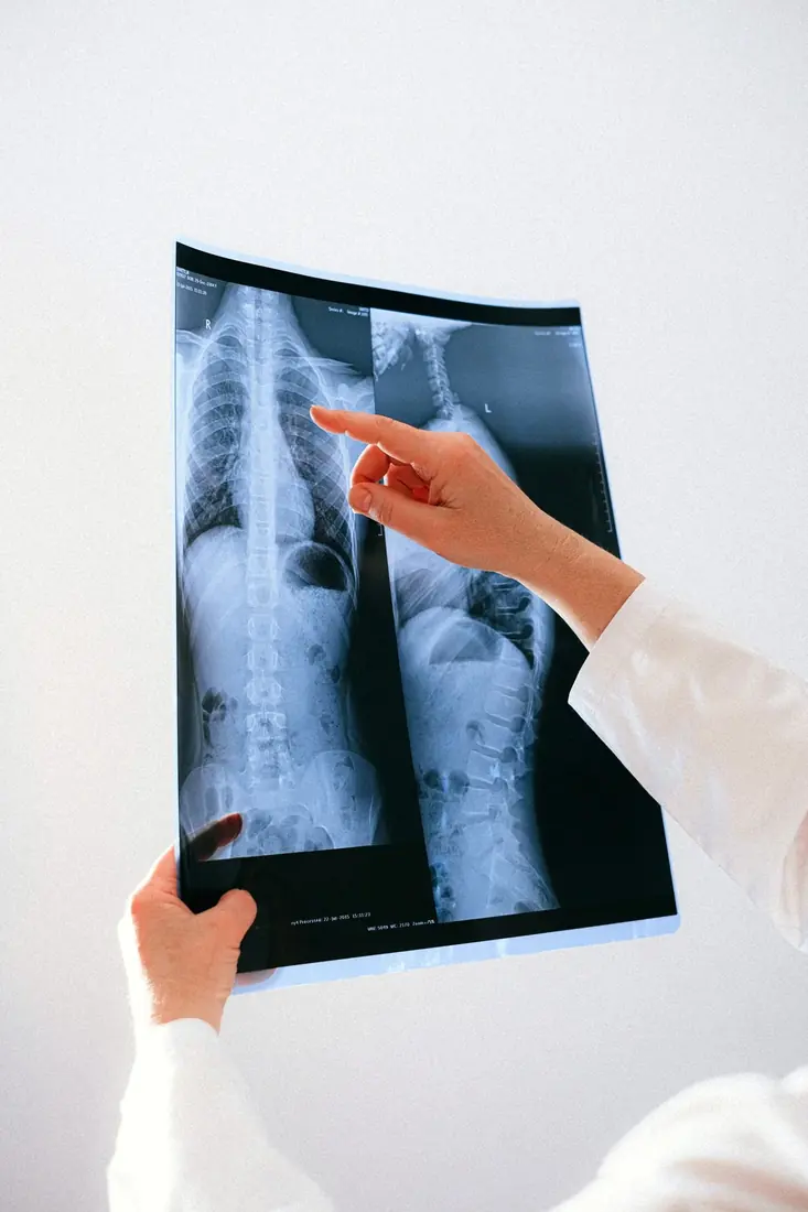 Spinal X-ray films being reviewed